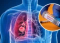 UK Developing Worlds First Lung Cancer Vaccine LungVax