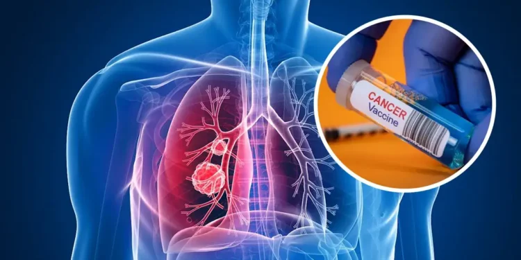 UK Developing Worlds First Lung Cancer Vaccine LungVax